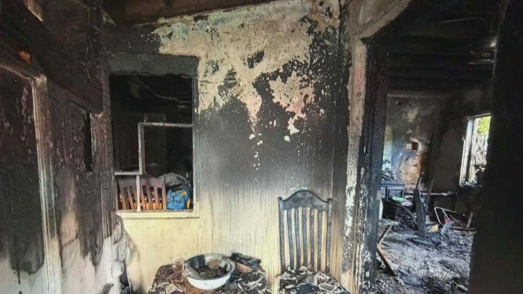 Woman hospitalized after Miami house fire leaves three displaced — CBS Miami, Grand Prairie Health news